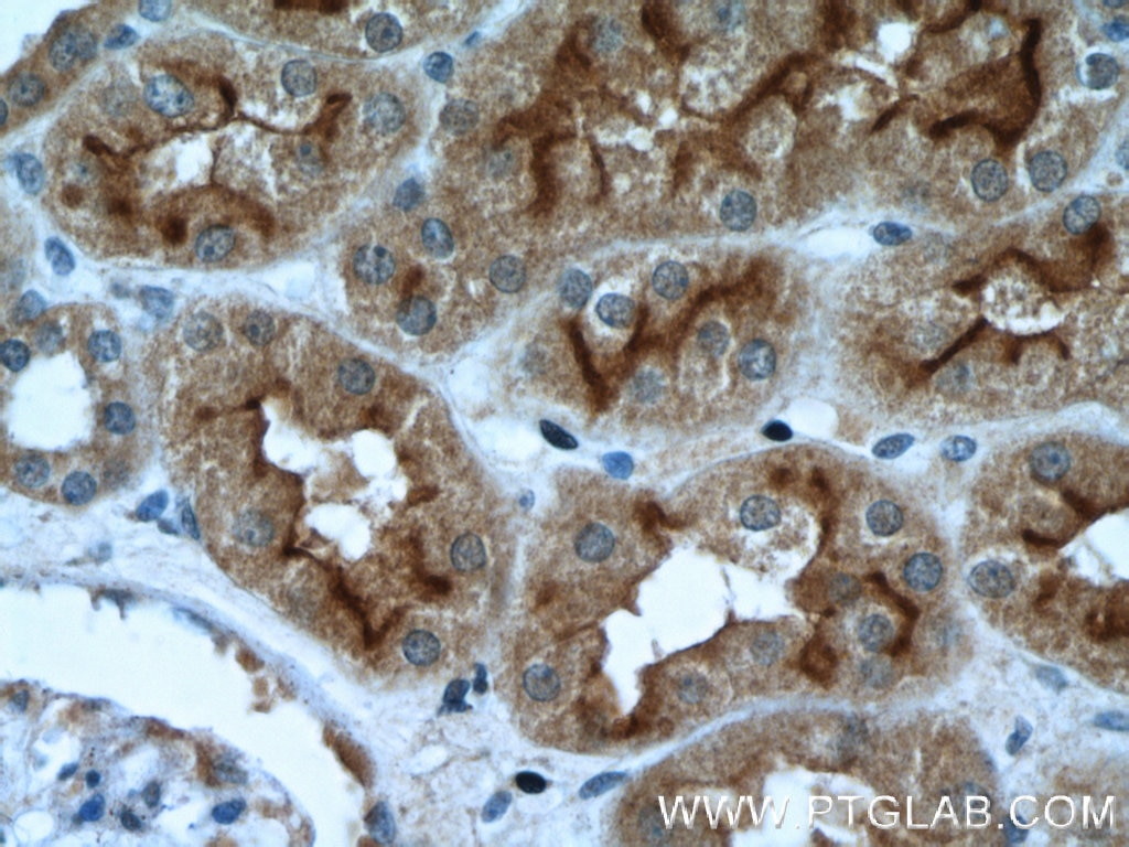 Immunohistochemistry (IHC) staining of human kidney tissue using SGLT2 Polyclonal antibody (24654-1-AP)