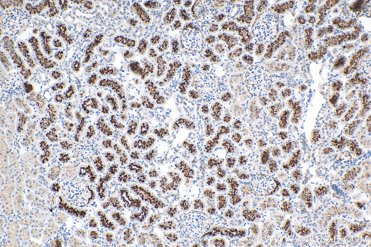IHC staining of rat kidney using 24654-1-AP