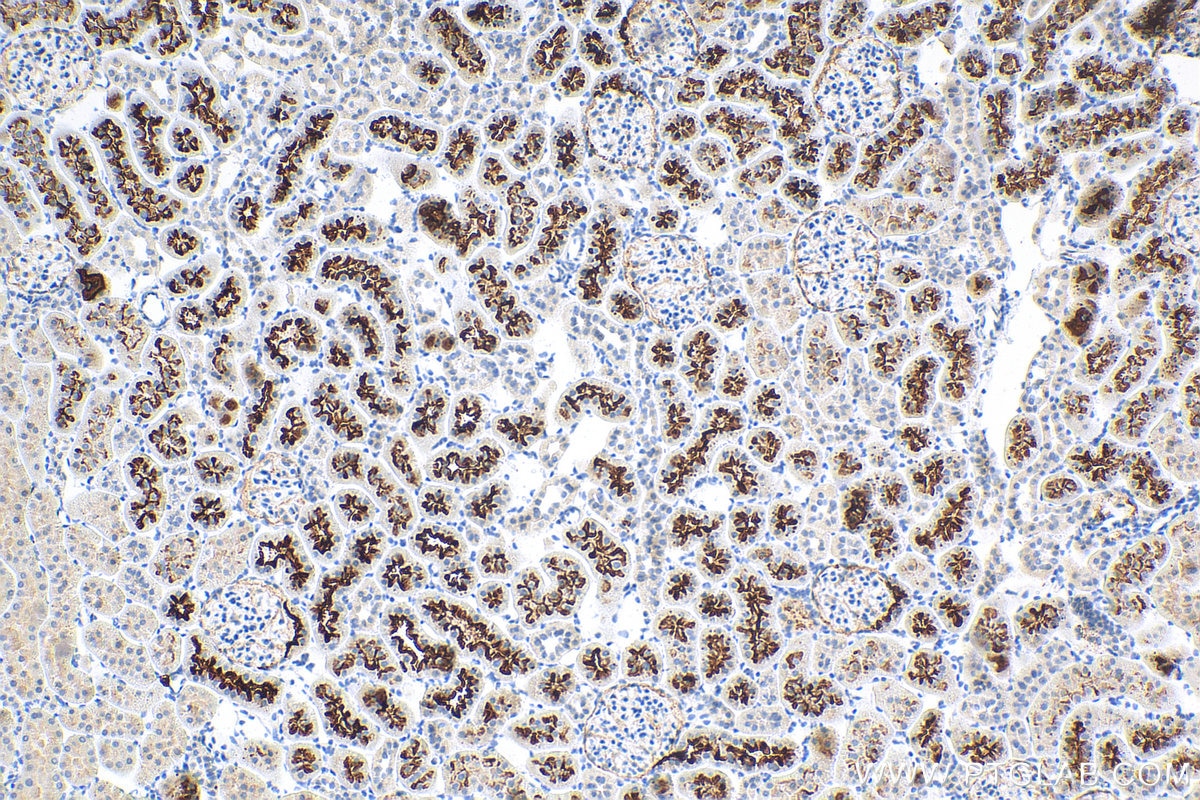 Immunohistochemistry (IHC) staining of rat kidney tissue using SGLT2 Polyclonal antibody (24654-1-AP)