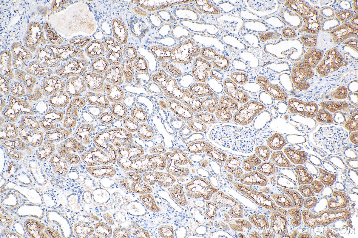 Immunohistochemistry (IHC) staining of human kidney tissue using SGLT2 Polyclonal antibody (24654-1-AP)