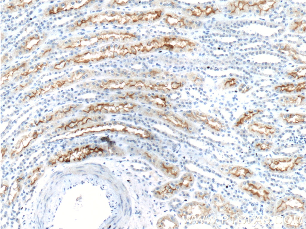 Immunohistochemistry (IHC) staining of human kidney tissue using SGLT2 Polyclonal antibody (24654-1-AP)