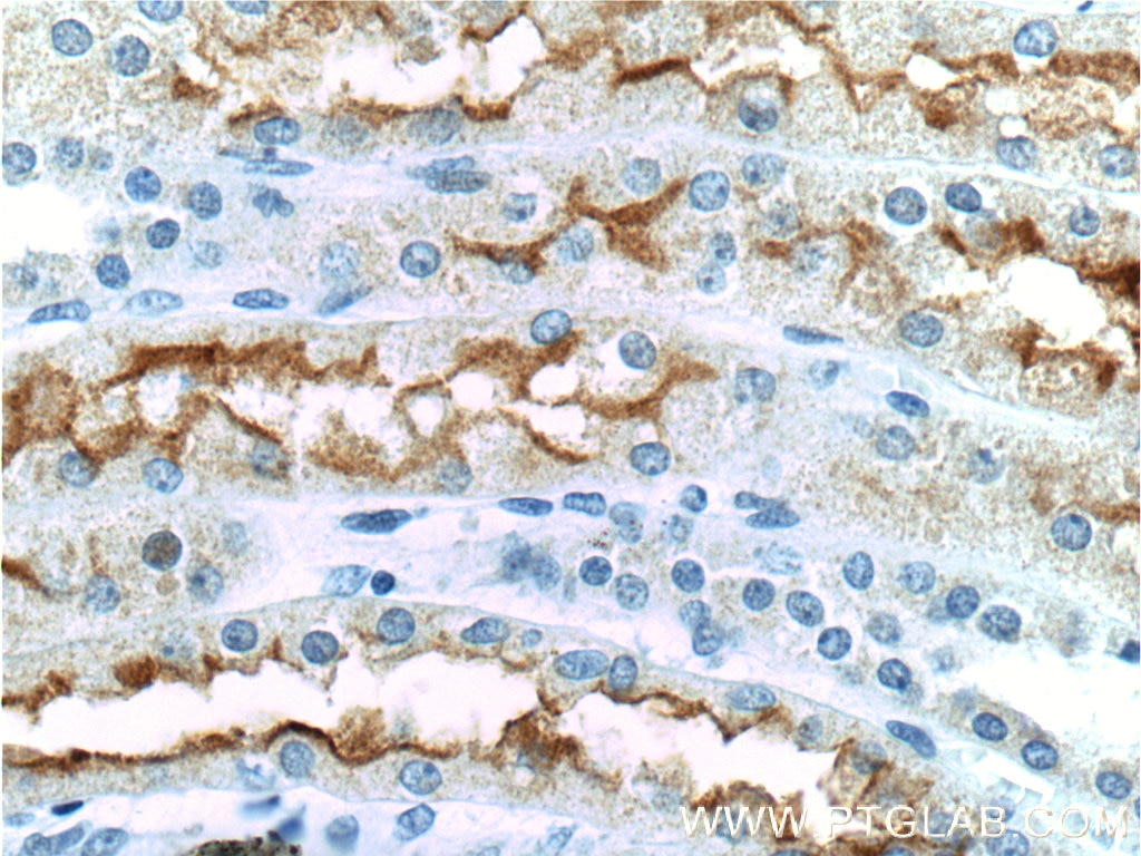 Immunohistochemistry (IHC) staining of human kidney tissue using SGLT2 Polyclonal antibody (24654-1-AP)