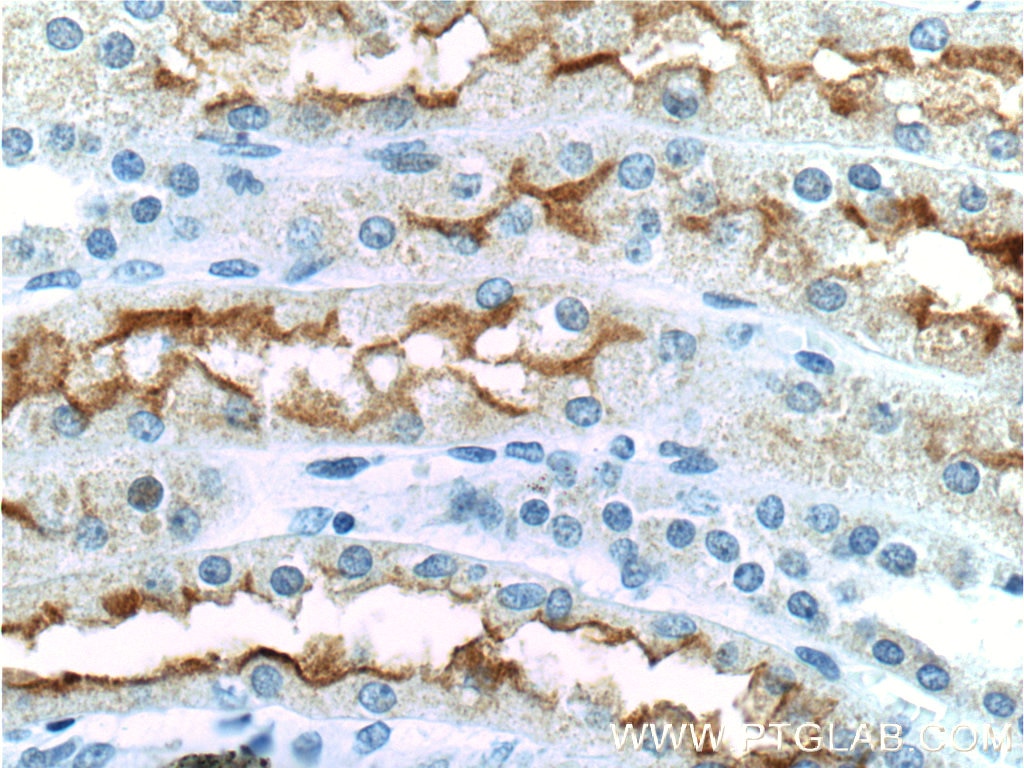 Immunohistochemistry (IHC) staining of human kidney tissue using SGLT2 Polyclonal antibody (24654-1-AP)