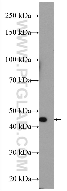 Western Blot (WB) analysis of mouse kidney tissue using SGLT2 Polyclonal antibody (24654-1-AP)