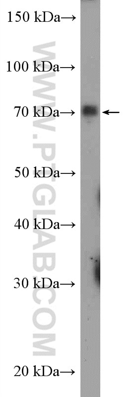 Western Blot (WB) analysis of A549 cells using SGLT2 Polyclonal antibody (24654-1-AP)