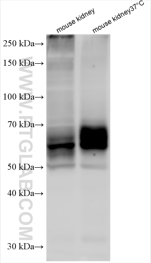 Western Blot (WB) analysis of various lysates using SGLT2 Polyclonal antibody (24654-1-AP)