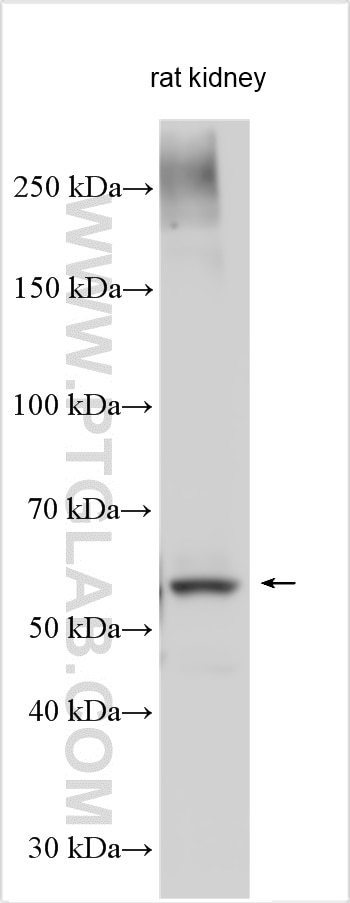 Western Blot (WB) analysis of various lysates using SGLT2 Polyclonal antibody (24654-1-AP)