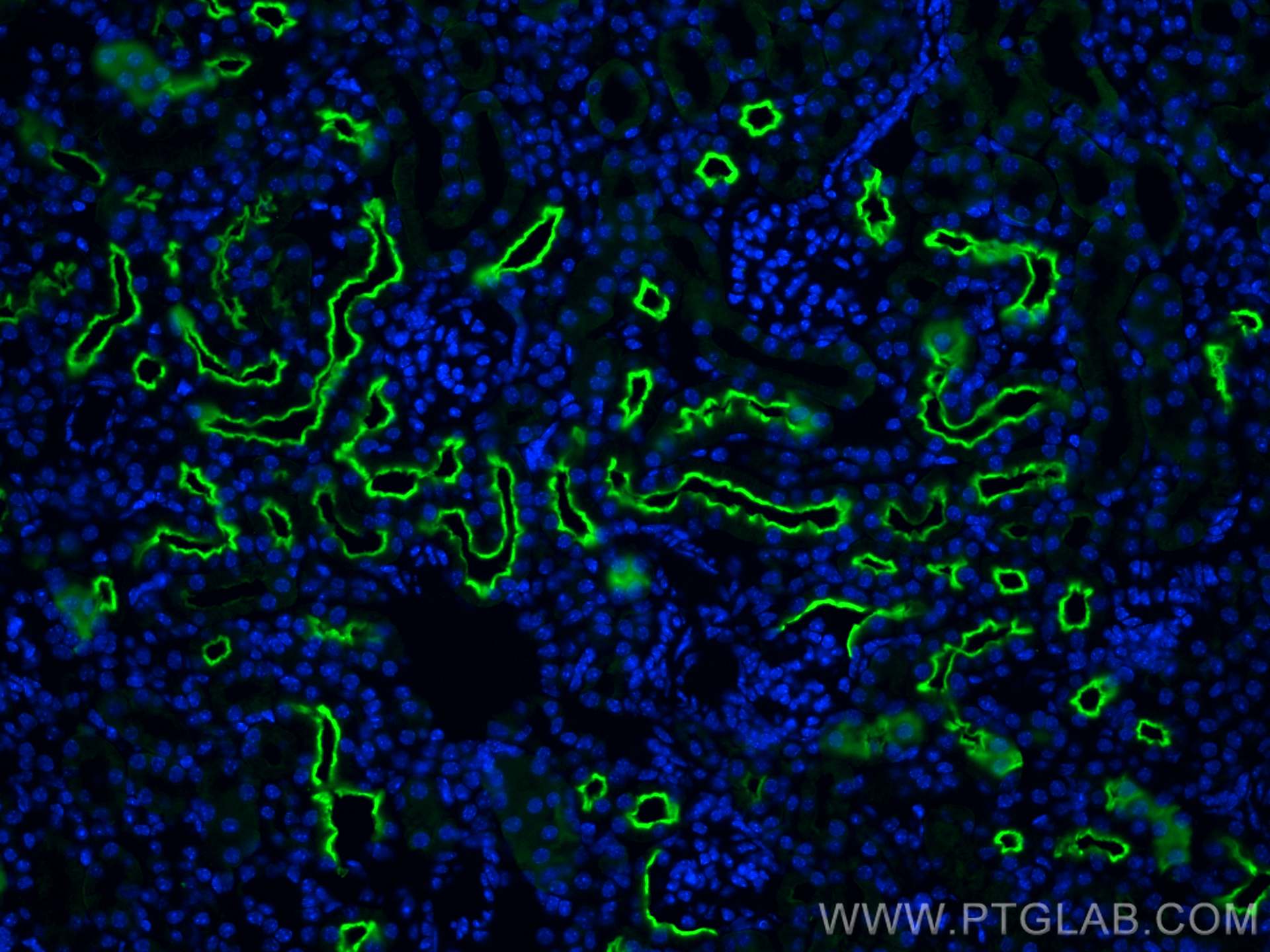 Immunofluorescence (IF) / fluorescent staining of mouse kidney tissue using SGLT2 Polyclonal antibody (28683-1-AP)
