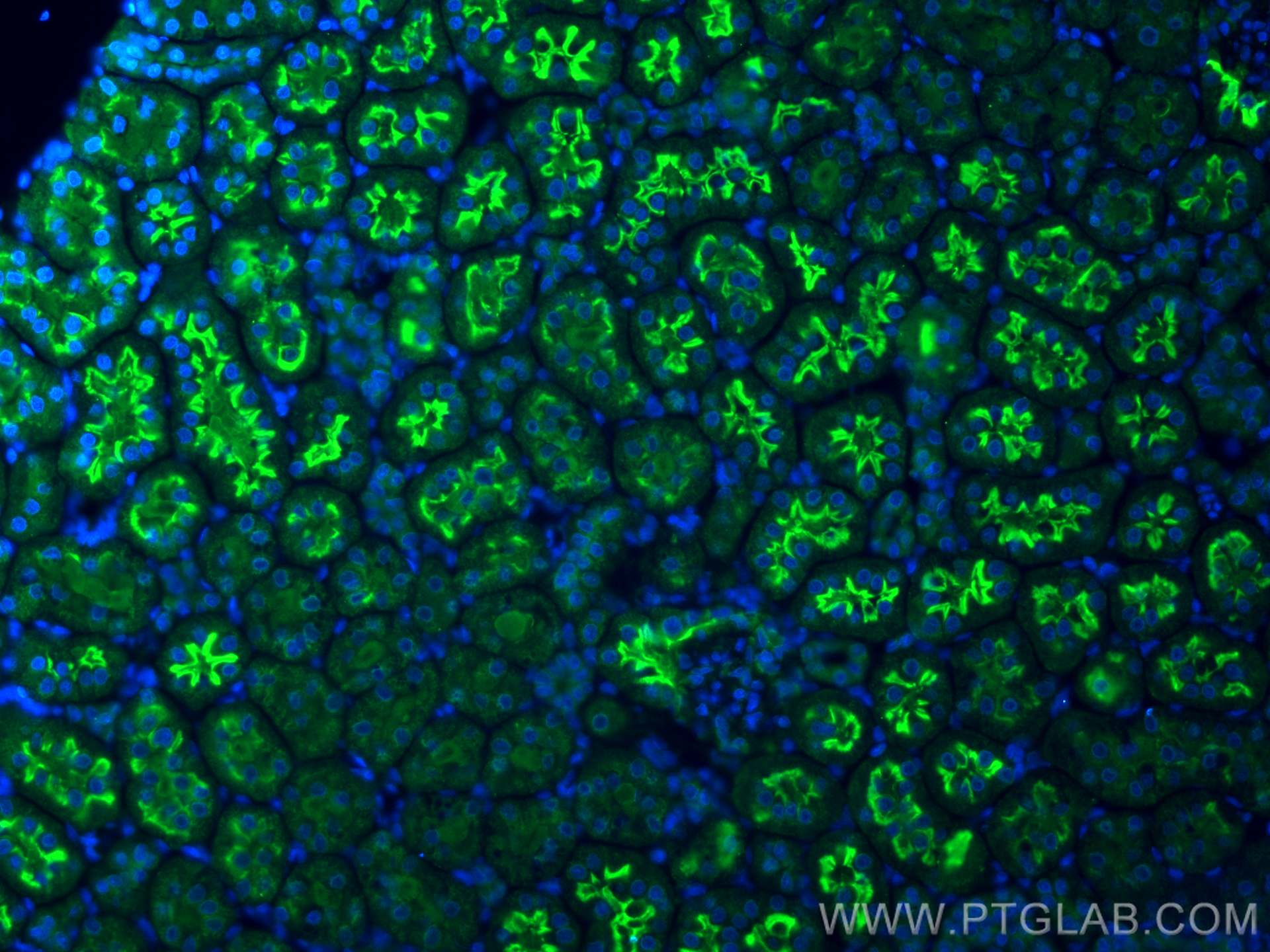 Immunofluorescence (IF) / fluorescent staining of rat kidney tissue using SGLT2 Polyclonal antibody (28683-1-AP)