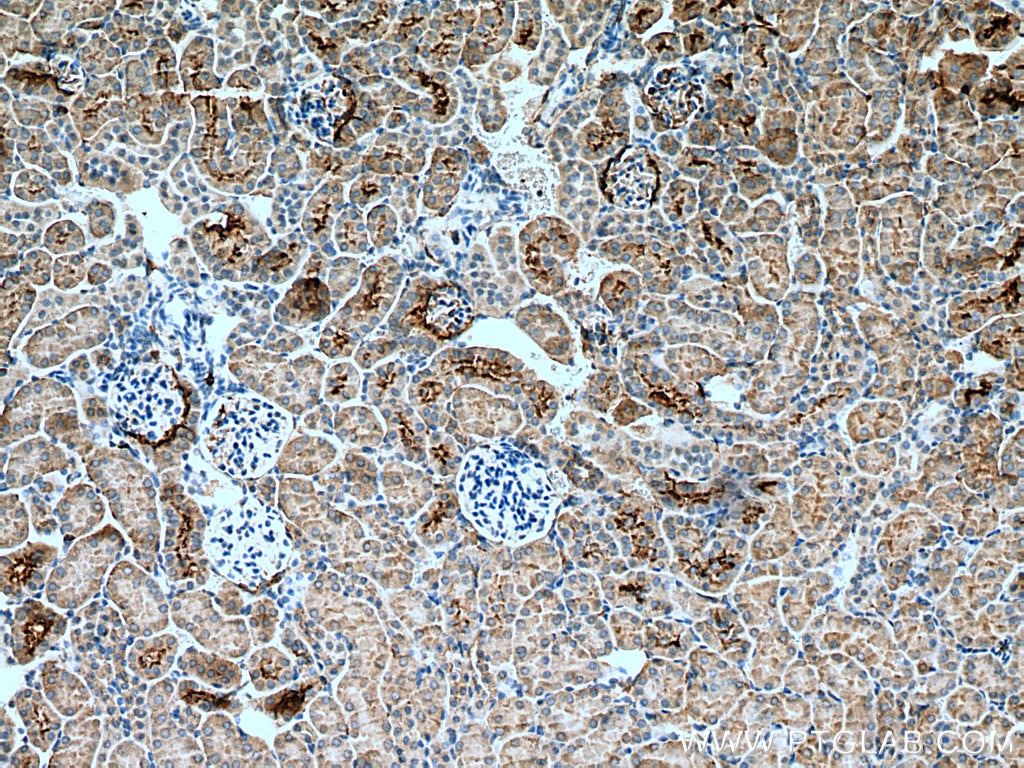 Immunohistochemistry (IHC) staining of mouse kidney tissue using SGLT2 Polyclonal antibody (28683-1-AP)