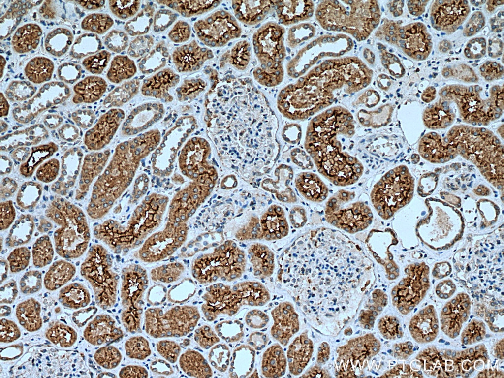 Immunohistochemistry (IHC) staining of human kidney tissue using SGLT2 Polyclonal antibody (28683-1-AP)