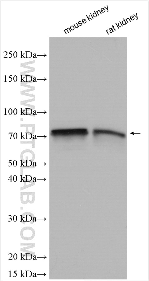 Western Blot (WB) analysis of various lysates using SGLT2 Polyclonal antibody (28683-1-AP)