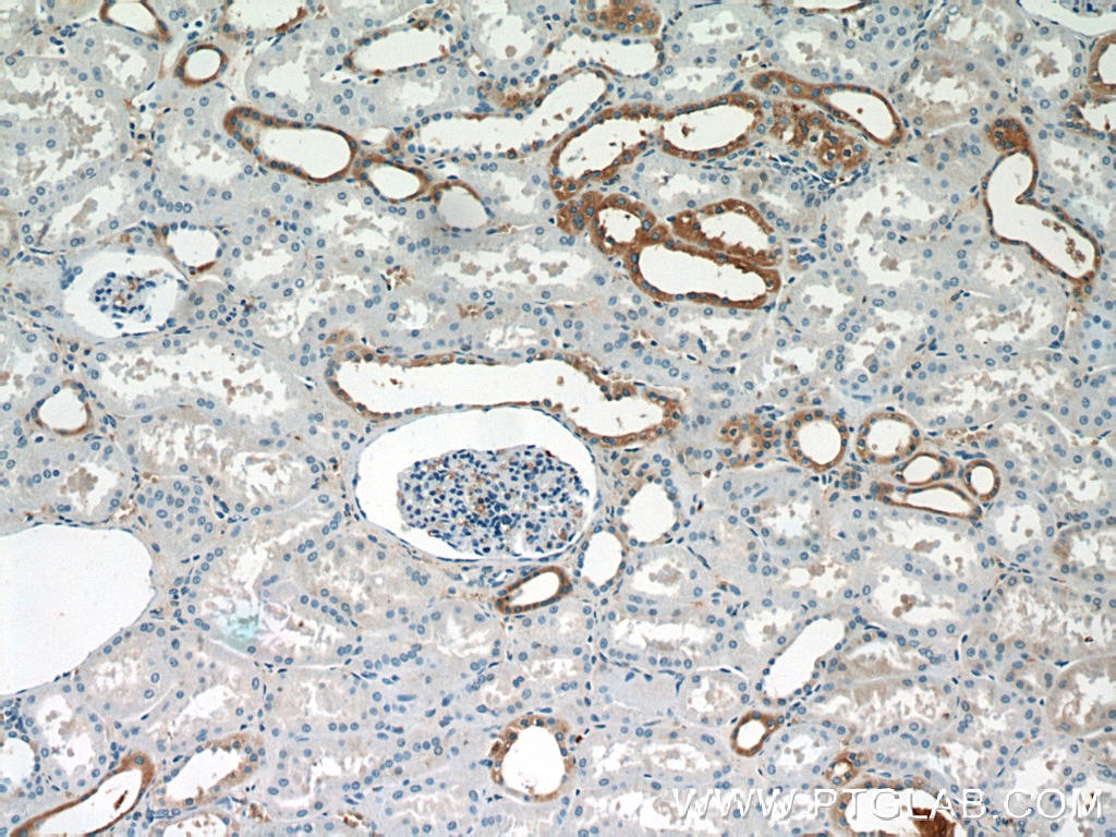 Immunohistochemistry (IHC) staining of human kidney tissue using SGLT3/SLC5A4 Polyclonal antibody (24327-1-AP)