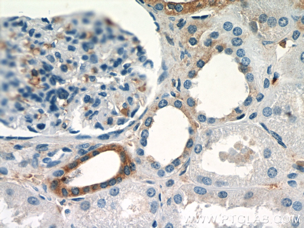 Immunohistochemistry (IHC) staining of human kidney tissue using SGLT3/SLC5A4 Polyclonal antibody (24327-1-AP)