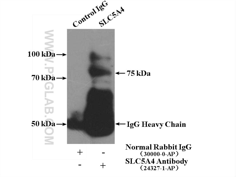 Immunoprecipitation (IP) experiment of mouse kidney tissue using SGLT3/SLC5A4 Polyclonal antibody (24327-1-AP)