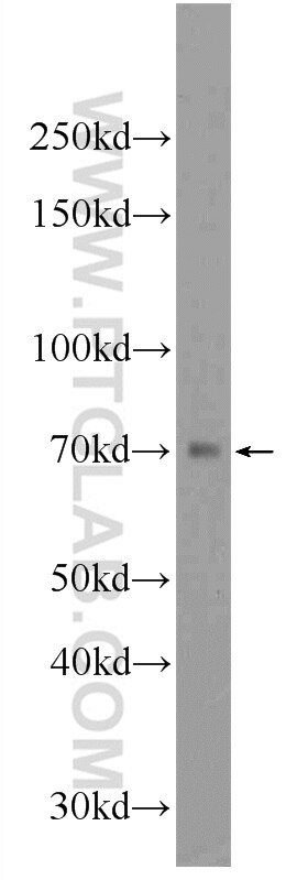Western Blot (WB) analysis of mouse kidney tissue using SGLT3/SLC5A4 Polyclonal antibody (24327-1-AP)