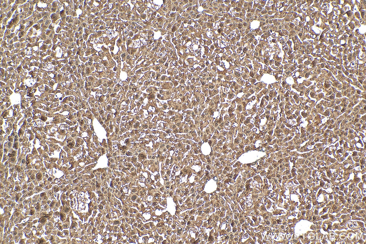 Immunohistochemistry (IHC) staining of mouse liver tissue using SGMS1 Polyclonal antibody (19050-1-AP)