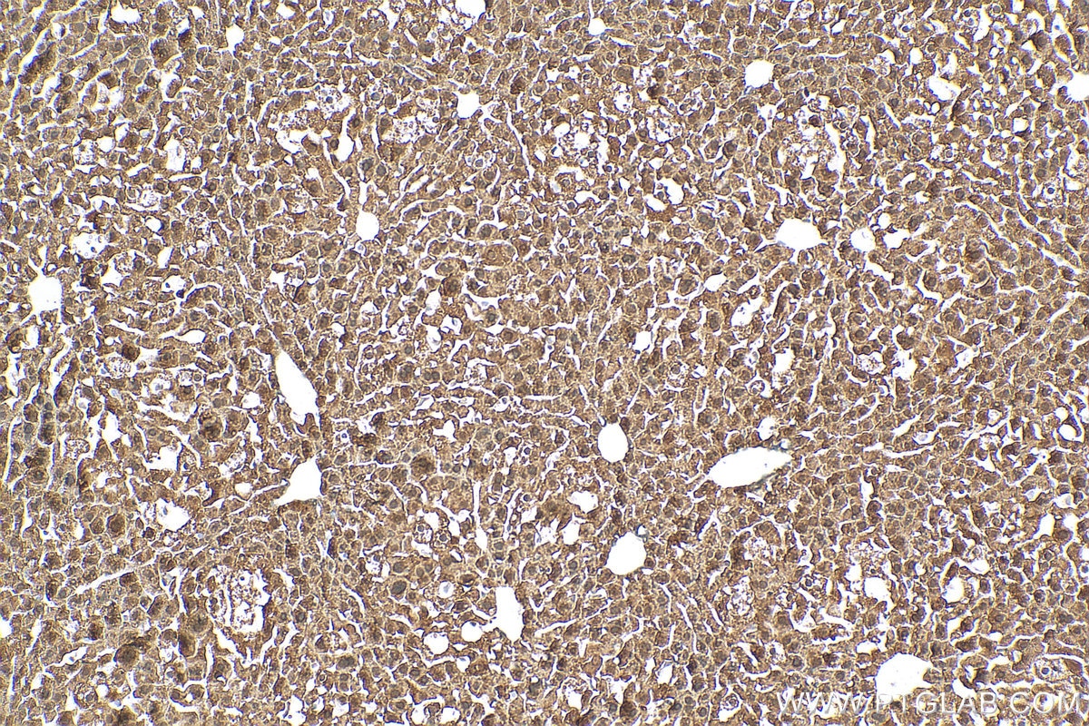 IHC staining of mouse liver using 19050-1-AP