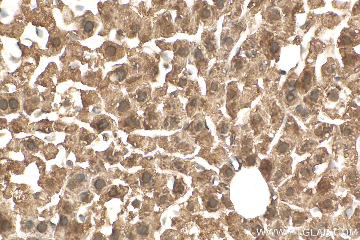 Immunohistochemistry (IHC) staining of mouse liver tissue using SGMS1 Polyclonal antibody (19050-1-AP)