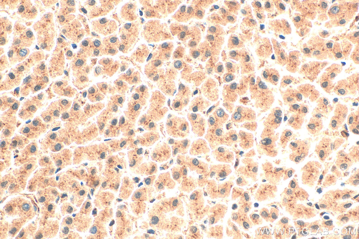 Immunohistochemistry (IHC) staining of human liver tissue using SGMS1 Polyclonal antibody (19050-1-AP)