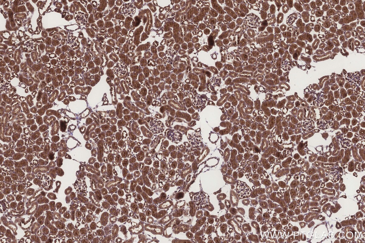 Immunohistochemistry (IHC) staining of mouse kidney tissue using SGMS1 Polyclonal antibody (19050-1-AP)
