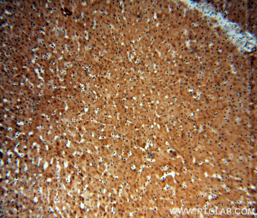 Immunohistochemistry (IHC) staining of human liver tissue using SGMS1 Polyclonal antibody (19050-1-AP)
