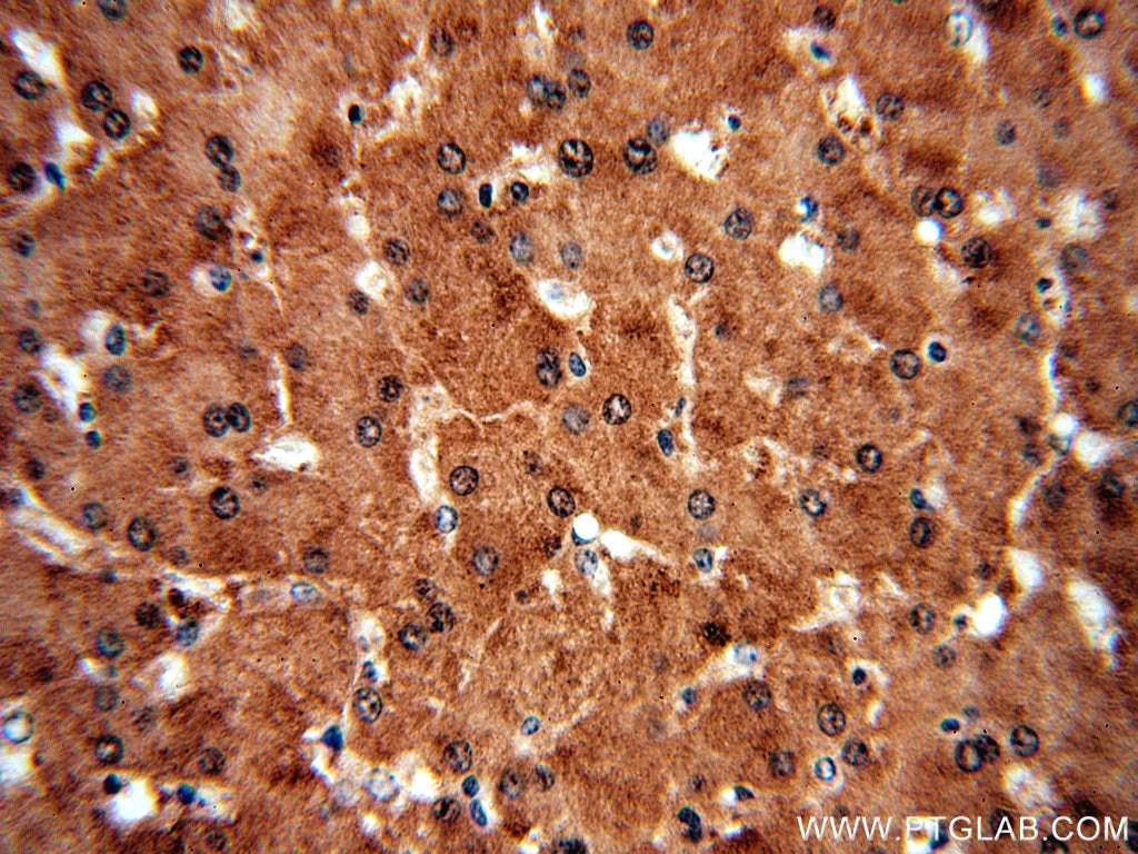 Immunohistochemistry (IHC) staining of human liver tissue using SGMS1 Polyclonal antibody (19050-1-AP)