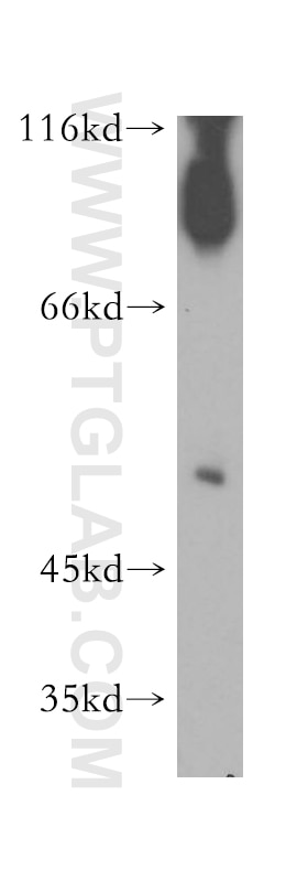 Western Blot (WB) analysis of human heart tissue using SGMS1 Polyclonal antibody (19050-1-AP)