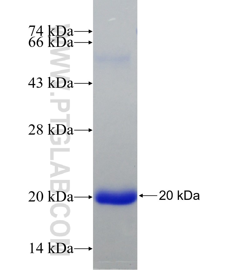 SGMS1 fusion protein Ag5246 SDS-PAGE