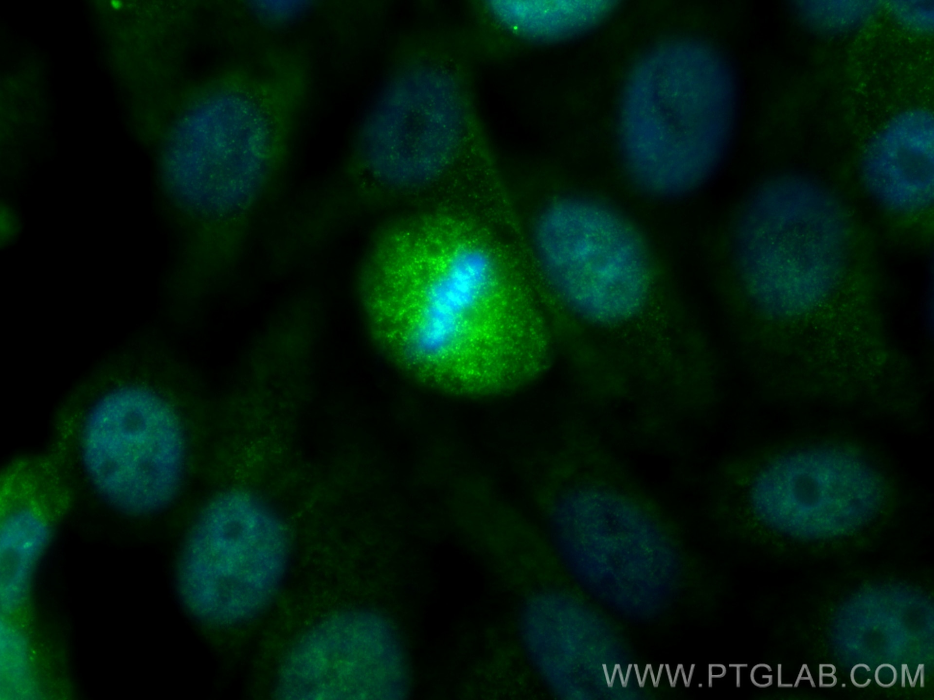Immunofluorescence (IF) / fluorescent staining of HeLa cells using SGOL1 Polyclonal antibody (16977-1-AP)