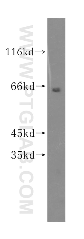 Western Blot (WB) analysis of PC-3 cells using SGOL1 Polyclonal antibody (16977-1-AP)