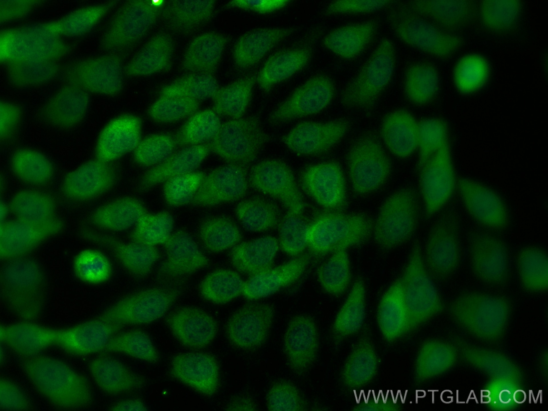 Immunofluorescence (IF) / fluorescent staining of A431 cells using SGOL2 Polyclonal antibody (30867-1-AP)