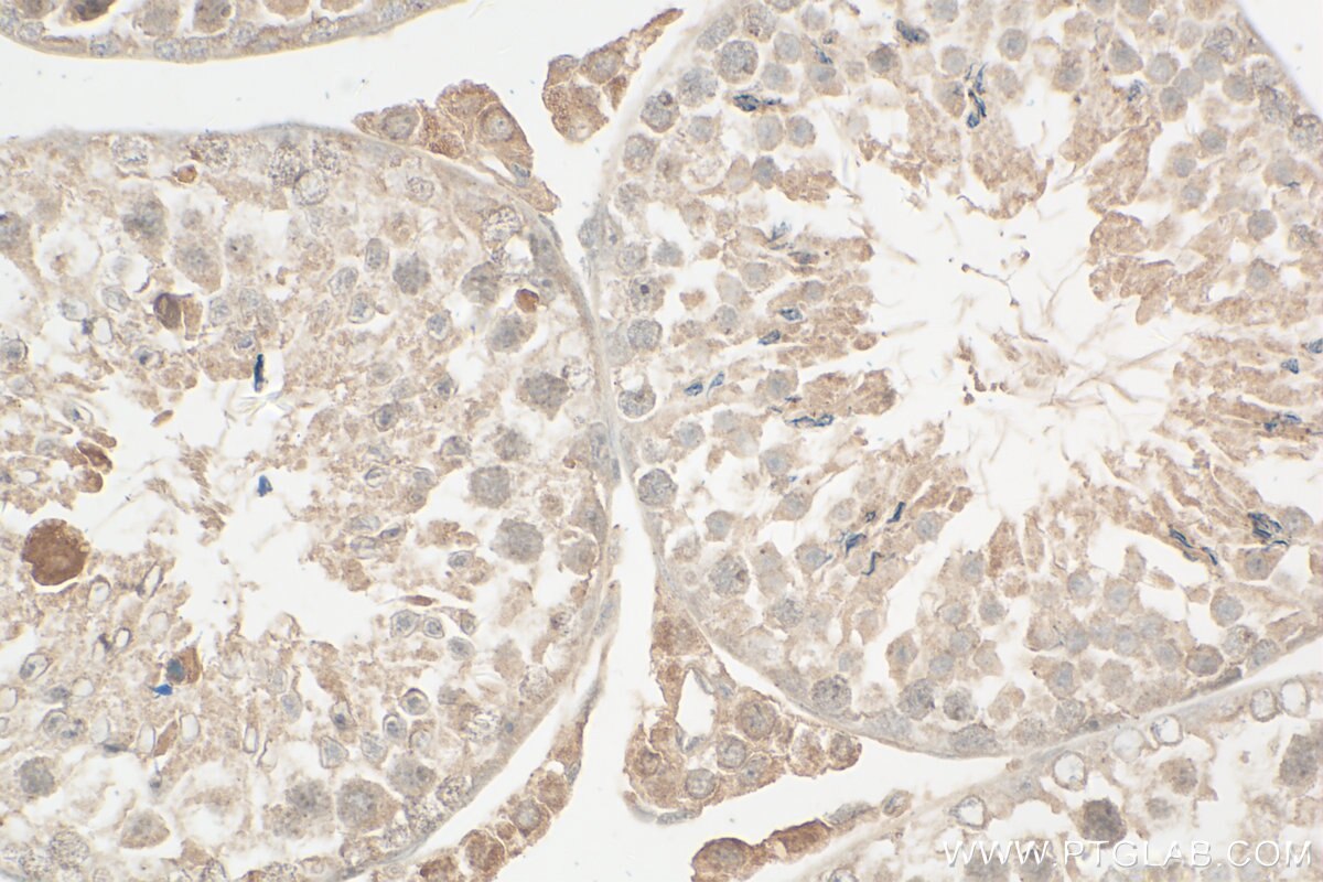 Immunohistochemistry (IHC) staining of mouse testis tissue using SGOL2 Polyclonal antibody (30867-1-AP)