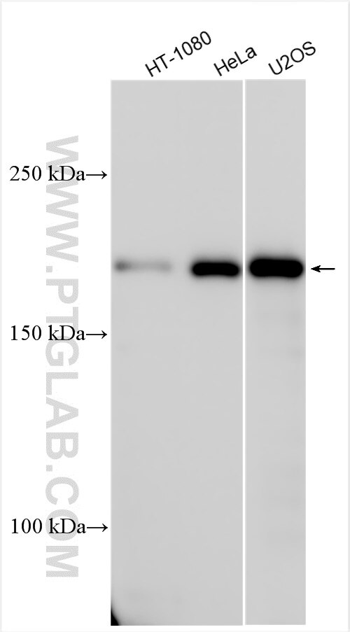 Western Blot (WB) analysis of various lysates using SGOL2 Polyclonal antibody (30867-1-AP)