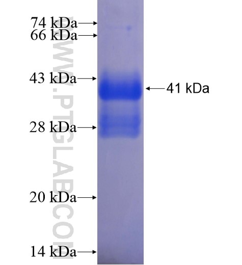 SGPP1 fusion protein Ag11914 SDS-PAGE