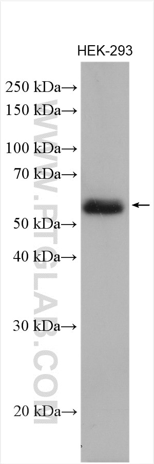 Western Blot (WB) analysis of various lysates using SGSH Polyclonal antibody (28150-1-AP)