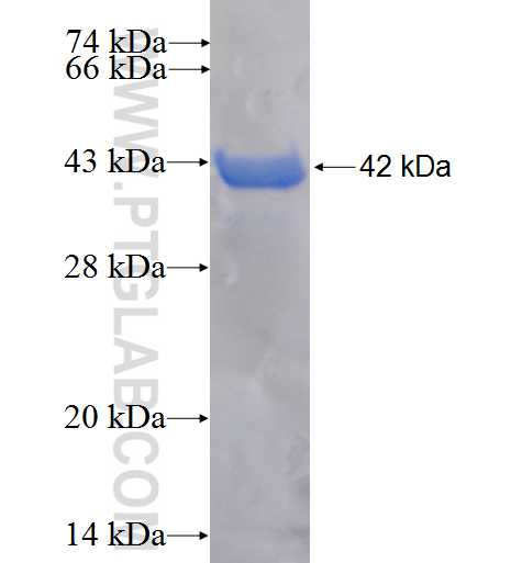 SGSH fusion protein Ag6022 SDS-PAGE