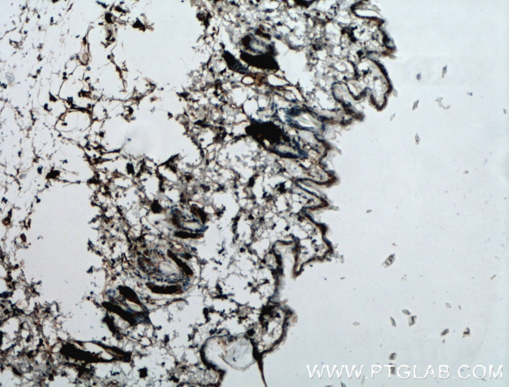 Immunohistochemistry (IHC) staining of mouse skin tissue using SGSM1 Polyclonal antibody (21395-1-AP)