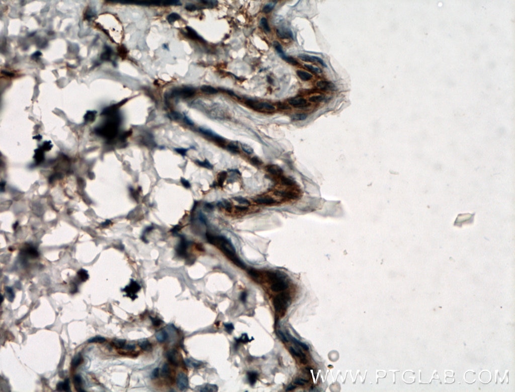 Immunohistochemistry (IHC) staining of mouse skin tissue using SGSM1 Polyclonal antibody (21395-1-AP)