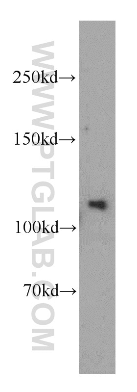 Western Blot (WB) analysis of mouse testis tissue using SGSM1 Polyclonal antibody (21395-1-AP)
