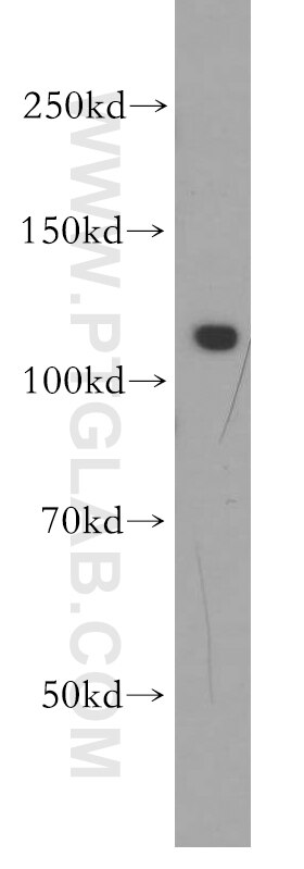 Western Blot (WB) analysis of mouse testis tissue using SGSM1 Polyclonal antibody (21395-1-AP)