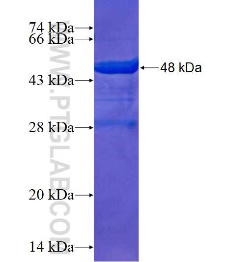SGSM1 fusion protein Ag16070 SDS-PAGE
