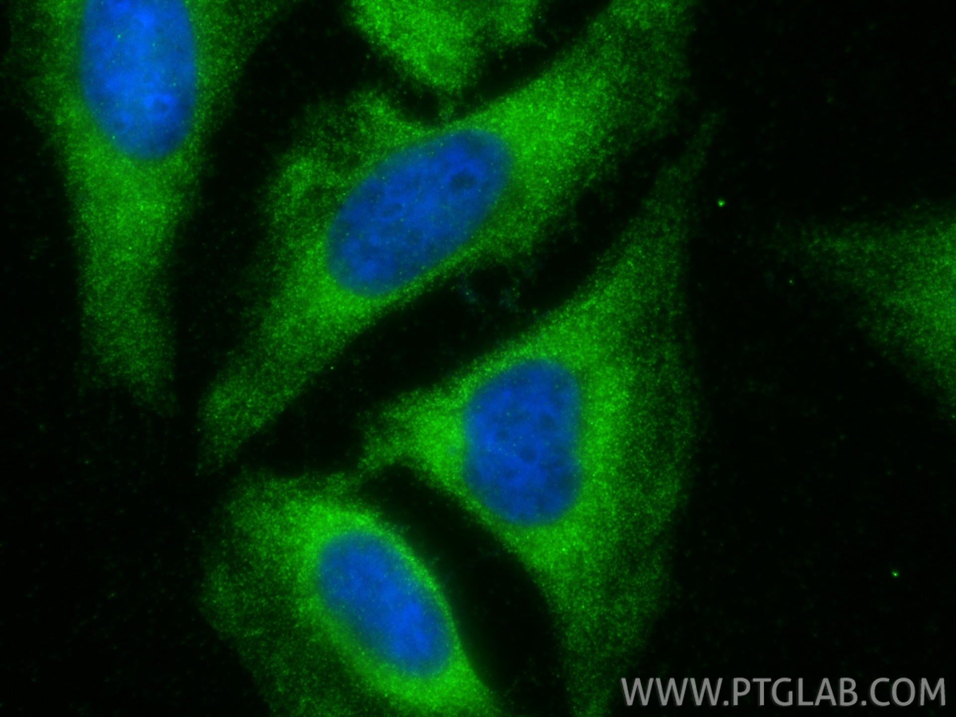 Immunofluorescence (IF) / fluorescent staining of HeLa cells using SGSM3 Polyclonal antibody (20825-1-AP)