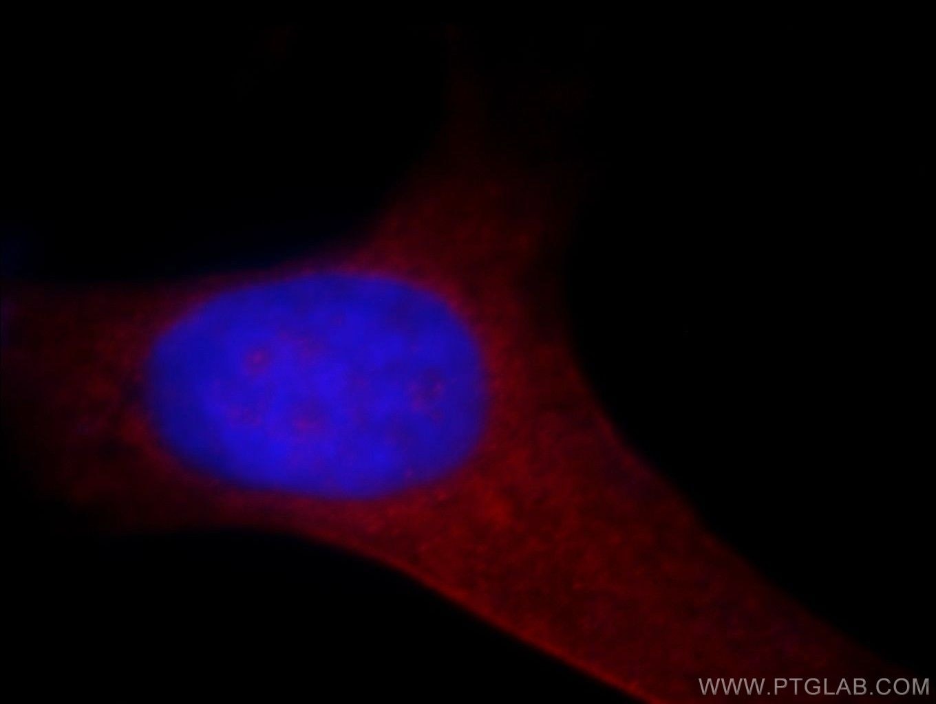 Immunofluorescence (IF) / fluorescent staining of HeLa cells using SGSM3 Polyclonal antibody (20825-1-AP)