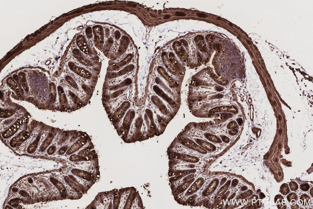 Immunohistochemistry (IHC) staining of mouse colon tissue using SGSM3 Polyclonal antibody (20825-1-AP)