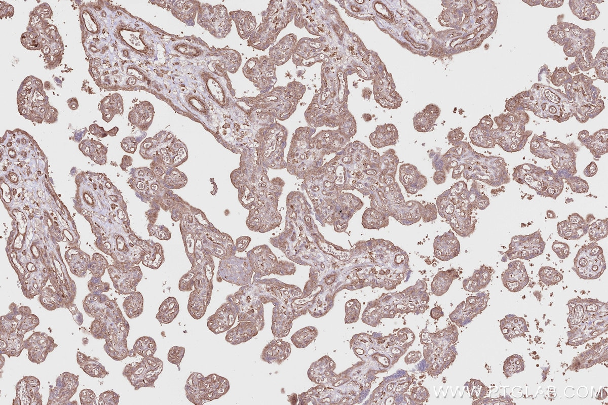Immunohistochemistry (IHC) staining of human placenta tissue using SGSM3 Polyclonal antibody (20825-1-AP)