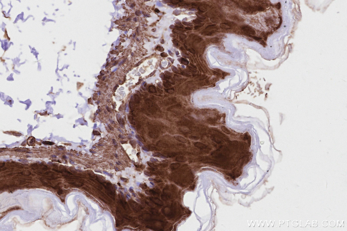 Immunohistochemistry (IHC) staining of mouse stomach tissue using SGSM3 Polyclonal antibody (20825-1-AP)