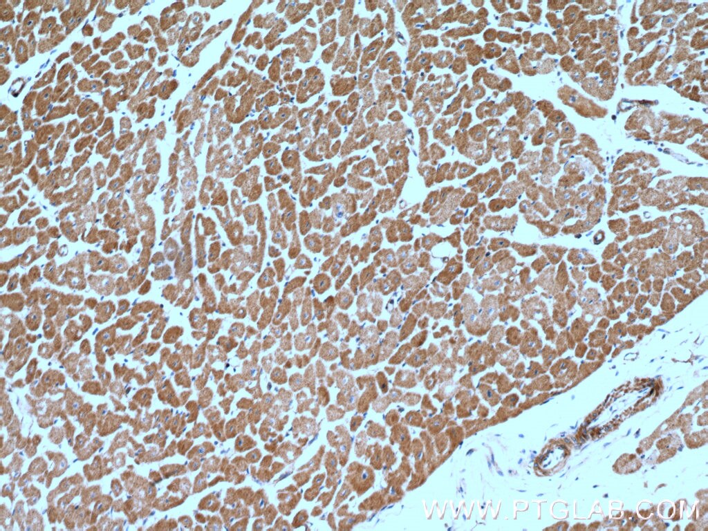 Immunohistochemistry (IHC) staining of human heart tissue using SGSM3 Polyclonal antibody (20825-1-AP)