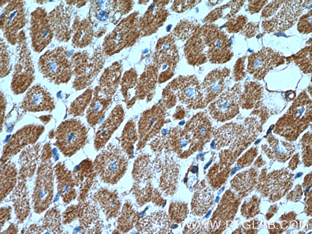 Immunohistochemistry (IHC) staining of human heart tissue using SGSM3 Polyclonal antibody (20825-1-AP)