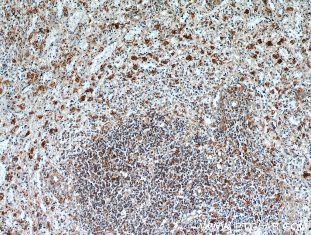 Immunohistochemistry (IHC) staining of human spleen tissue using SGSM3 Polyclonal antibody (20825-1-AP)